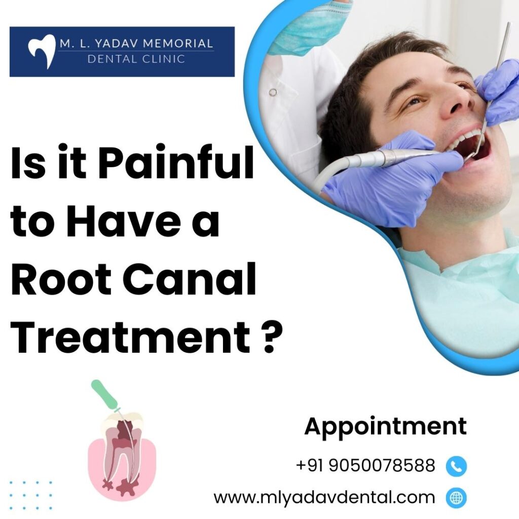 Is it Painful to Have a Root Canal Treatment?