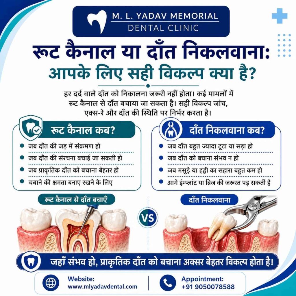 Root Canal or Tooth Extraction What Is the Right Option for You