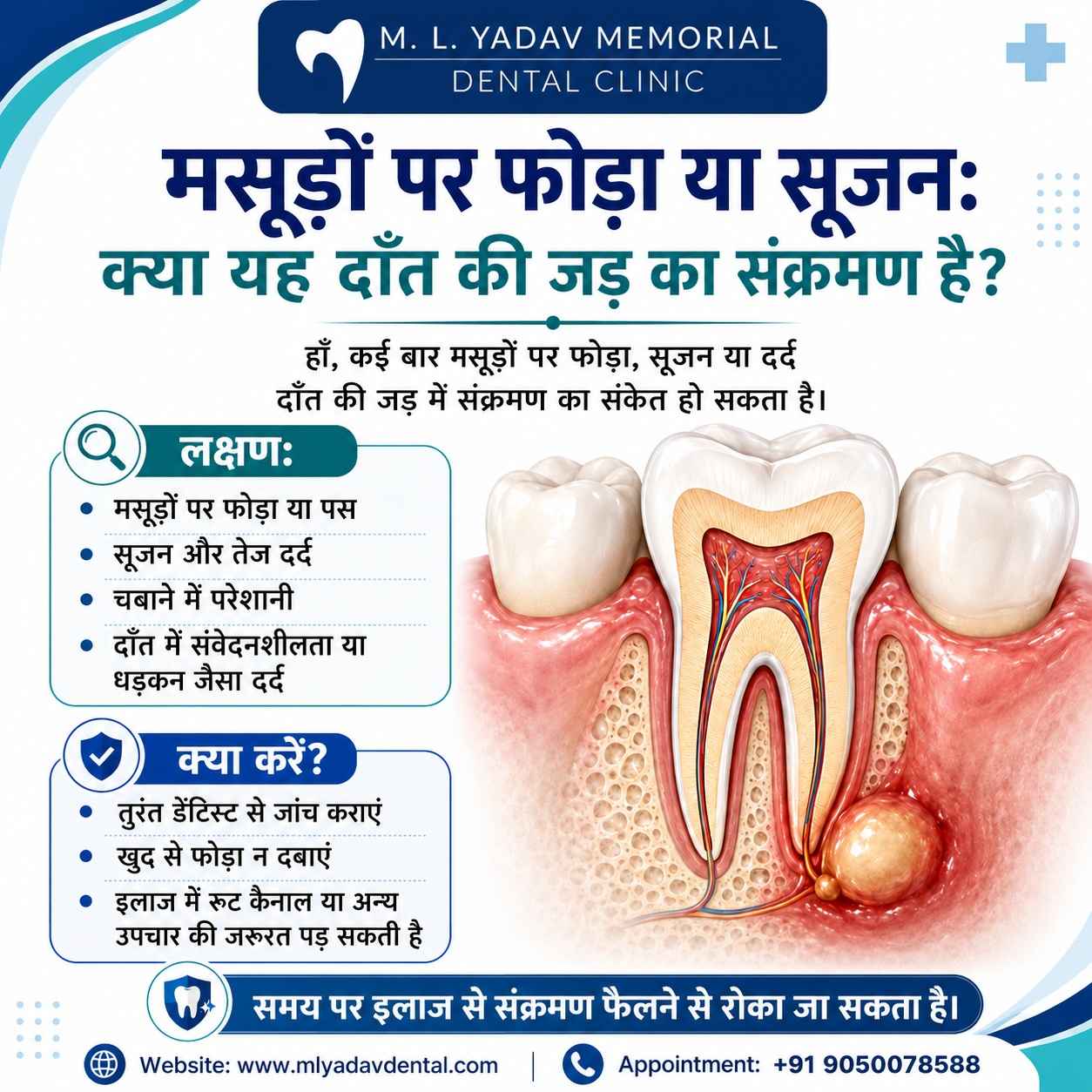 Abscess or swelling on the gums: Is it a tooth root infection?